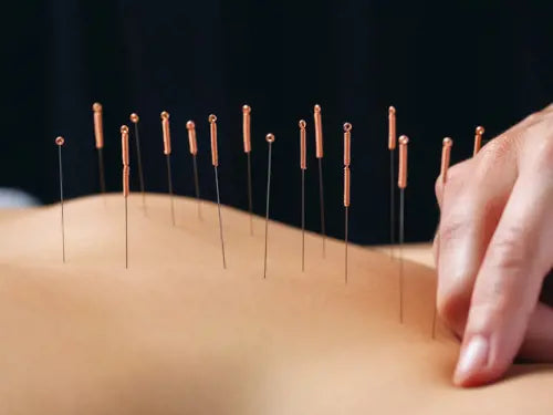 Acupuncture for the Dental Team 31/10/25 Ysbyty Gwynedd, Bangor, North Wales