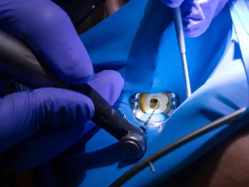 20 Best Tips for Endodontic Access and Shaping - Sam Johnson (Venue - Glan Clwyd Hospital)